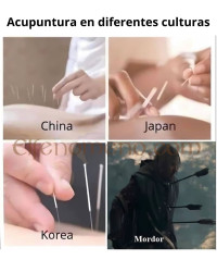 Meme: Acupuntura en diferentes culturas