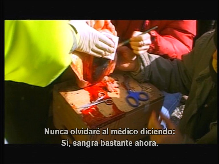 dvdldt34